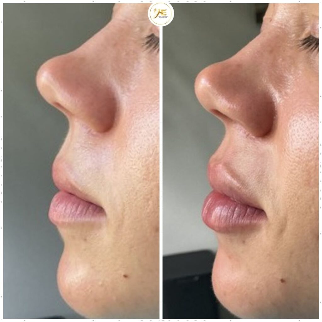 Before after minimal skincare Instagram post - 26