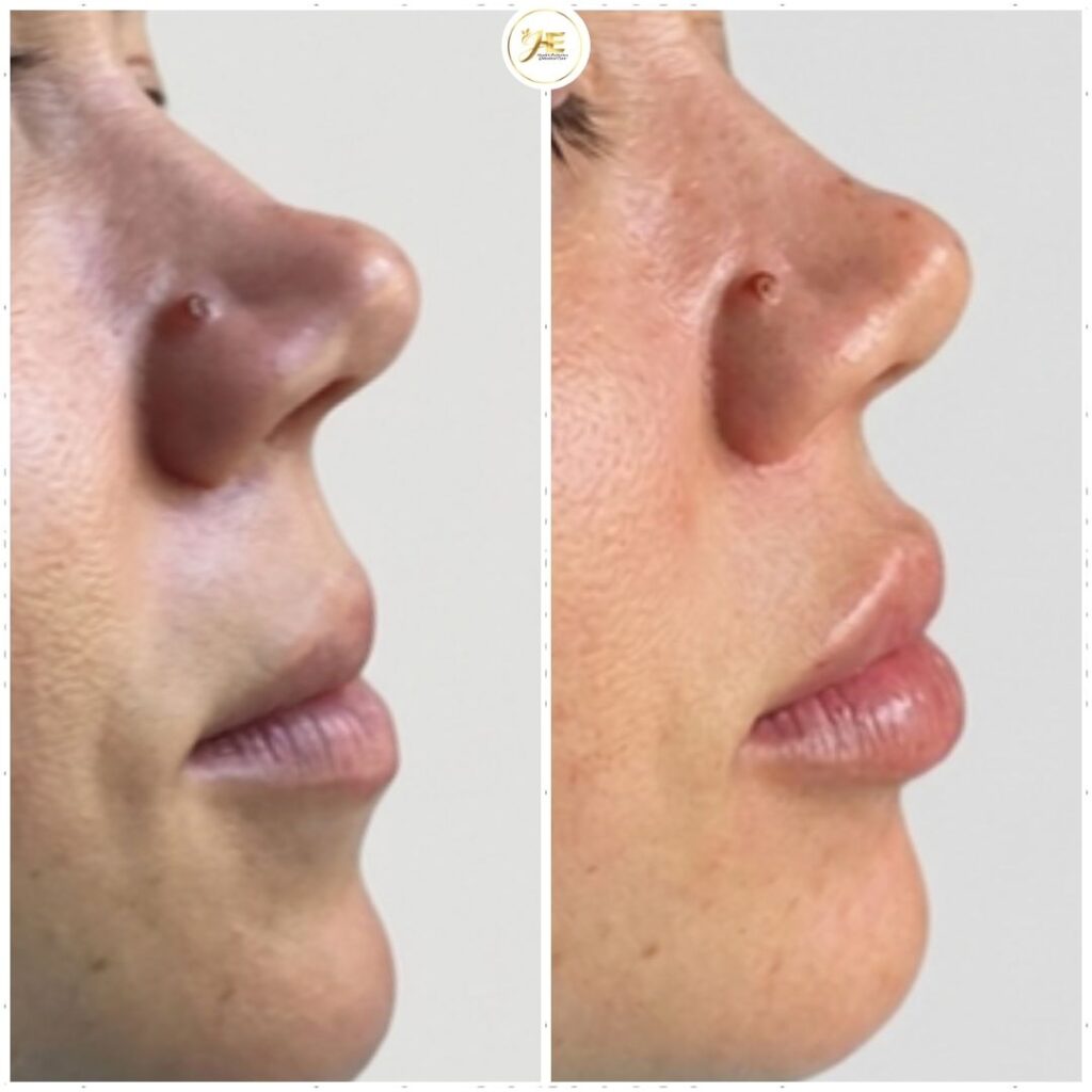 Before after minimal skincare Instagram post - 27