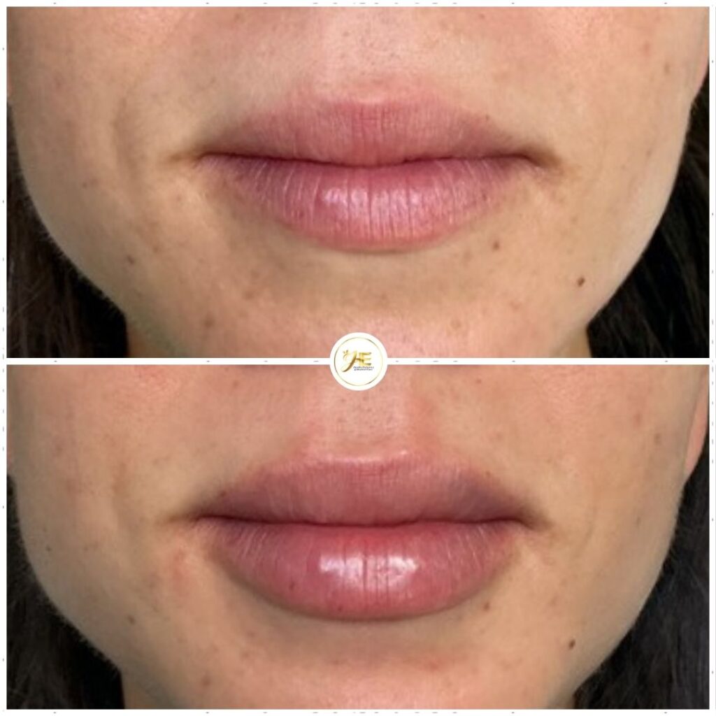 Before after minimal skincare Instagram post - 38